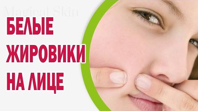 От чего появляются белые жировики на лице От чего появляются белые жировики на лице