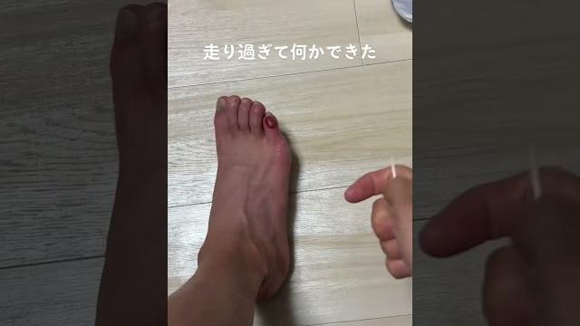 4週間連続で42.195kmフルマラソン走り続けた足がこちらです 4週間連続で42.195kmフルマラソン走り続けた足がこちらです