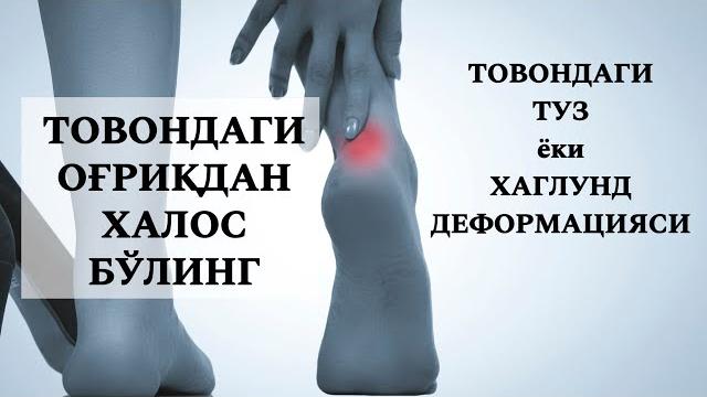 Товондаги тузни давоси, товондаги оғрикни даволаш, хаглунд деформация, ахилл пайи тендинити Товондаги тузни давоси, товондаги оғрикни даволаш, хаглунд деформация, ахилл пайи тендинити
