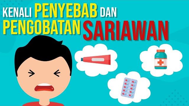 Cara mengobati sariawan Cara mengobati sariawan
