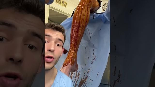 Nunca he trabajado en quirófano #shorts Nunca he trabajado en quirófano #shorts
