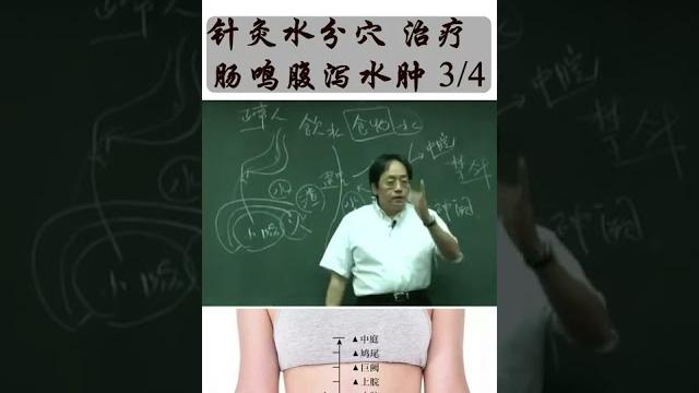 针灸 水分穴 治疗 肠鸣腹泻 3/4 针灸 水分穴 治疗 肠鸣腹泻 3/4