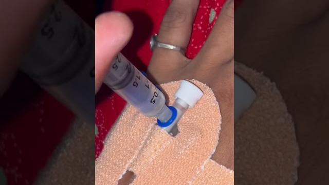 How to give injections in iv cannula | iv injection How to give injections in iv cannula | iv injection