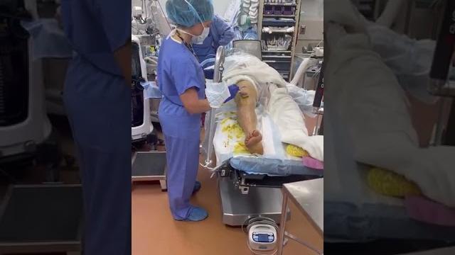 Cleaning the leg before knee replacement surgery Cleaning the leg before knee replacement surgery