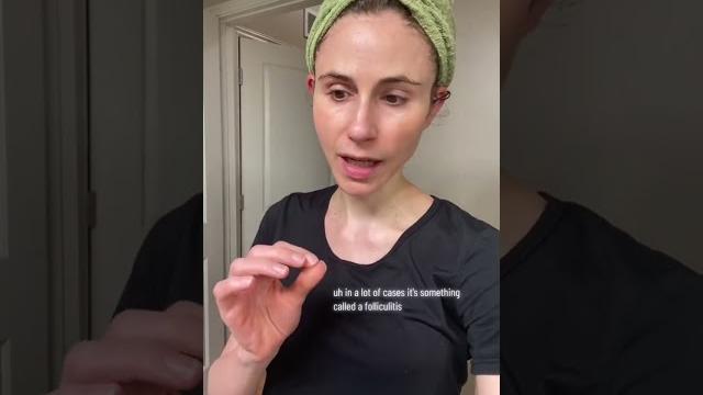 Painful butt pimples #dermatologist @drdrayzday Painful butt pimples #dermatologist @drdrayzday