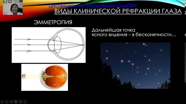 Зрительные функции, аккомодация,рефракция Зрительные функции, аккомодация,рефракция