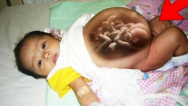 Una madre dio a luz a una hija que ya estaba embarazada Una madre dio a luz a una hija que ya estaba embarazada