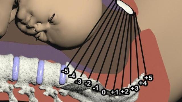 Seven cardinal movements of labor by cal shipley, m.d. Seven cardinal movements of labor by cal shipley, m.d.