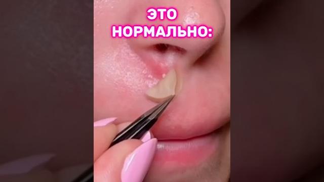 Если ты делаешь так, это нормально!🫶 Если ты делаешь так, это нормально!🫶