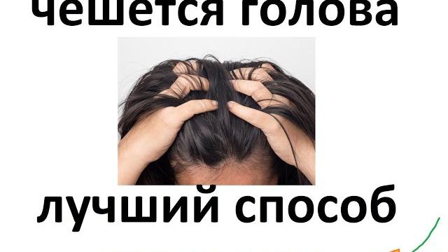 Чешется голова- лучший способ ! Чешется голова- лучший способ !