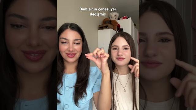 Damla’nın çenesi yer değiştirmiş Damla’nın çenesi yer değiştirmiş