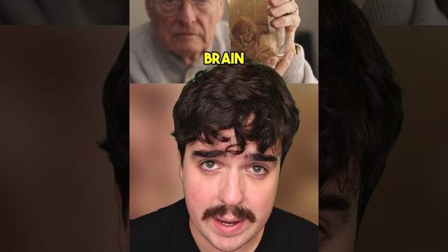 Einstein’s brain was stolen! Einstein’s brain was stolen!