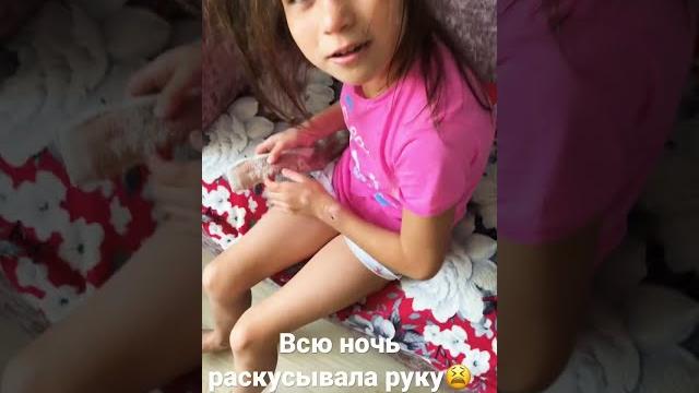 Аутист всю ночь разгрызала рукуночь без сна Аутист всю ночь разгрызала рукуночь без сна