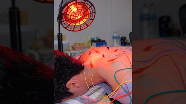 Asmr: incredible chinese electric acupuncture chiropractic and cupping massage #shorts Asmr: incredible chinese electric acupuncture chiropractic and cupping massage #shorts