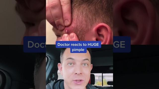 Giant pimple turns into massive infection | 208skindoc Giant pimple turns into massive infection | 208skindoc