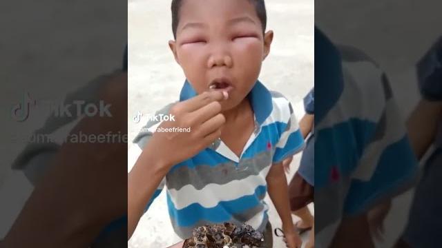 Ngakak! bocah balas dendam usai disengat lebah Ngakak! bocah balas dendam usai disengat lebah
