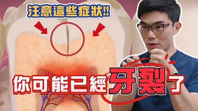 注意這些症狀!你可能已經牙裂了!|dr.wells 注意這些症狀!你可能已經牙裂了!|dr.wells