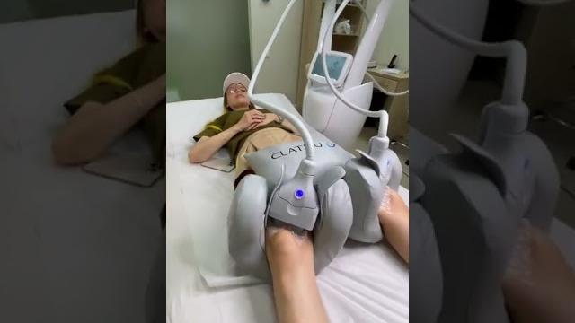 Заморозила жир на ногах! результат! Заморозила жир на ногах! результат!