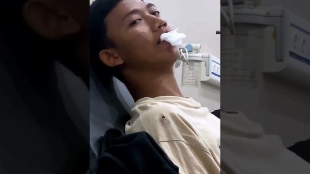 Saputra kecelekaan dari sepeda masuk rumah sakit, semoga lekas sembuh ya #shorts #mikaeltubehd Saputra kecelekaan dari sepeda masuk rumah sakit, semoga lekas sembuh ya #shorts #mikaeltubehd