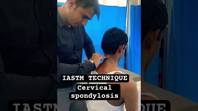 Iastm technique for#cervicalpain #cervical #iastm #physiotherapy #kotputlinews #cervicalspondylosis Iastm technique for#cervicalpain #cervical #iastm #physiotherapy #kotputlinews #cervicalspondylosis