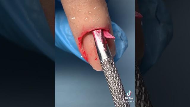 Watch me fix my clients nail(omg) Watch me fix my clients nail(omg)