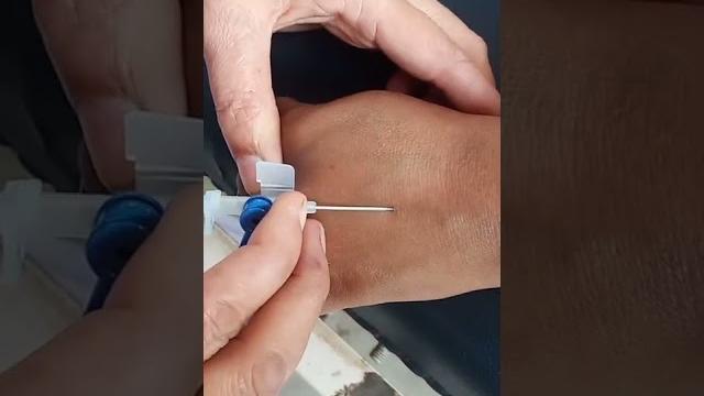 Iv cannula insertion Iv cannula insertion