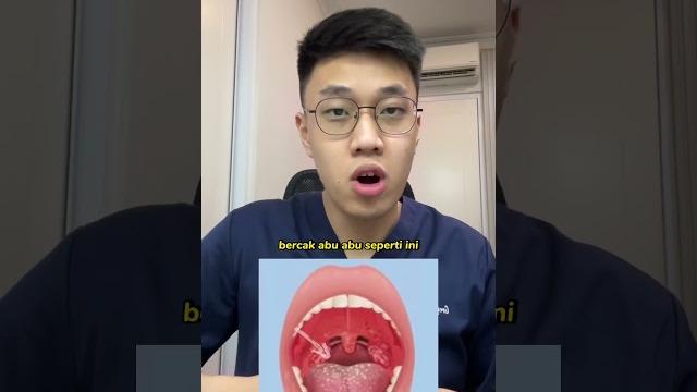 Aku yakin pasti sering deh kalian kena radang tenggorokan. nih aku kasih tau tips buat radang Aku yakin pasti sering deh kalian kena radang tenggorokan. nih aku kasih tau tips buat radang