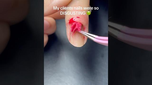 Cleaning nails #nailtutorial #nail #nailart Cleaning nails #nailtutorial #nail #nailart