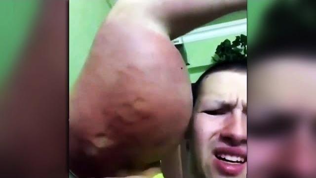 Кирилл терешин умирает!? | руки-базуки доигрался Кирилл терешин умирает!? | руки-базуки доигрался