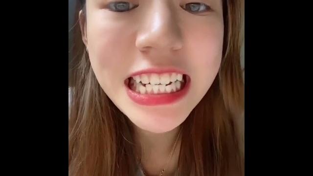 关注女大学生口腔健康口腔检查牙齿喉咙扁桃体欣赏了解更多 关注女大学生口腔健康口腔检查牙齿喉咙扁桃体欣赏了解更多