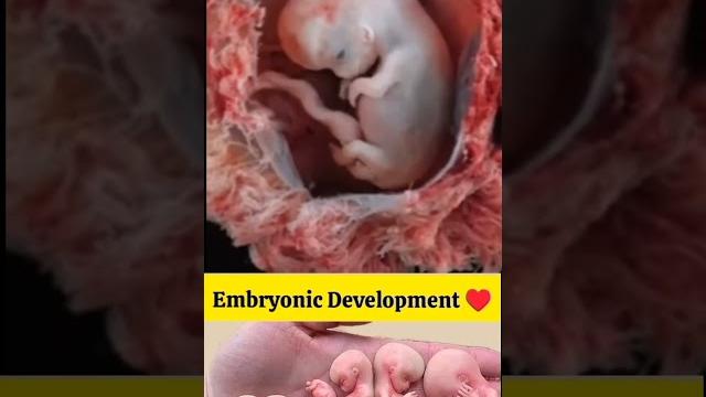 Tiny hand and feet development in baby Tiny hand and feet development in baby