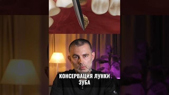 Консервация лунки зуба после удаления Консервация лунки зуба после удаления