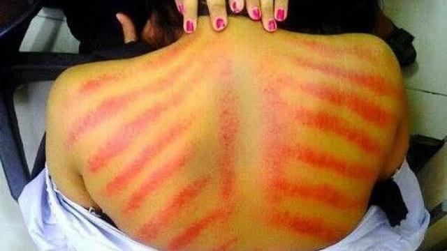 Pulang kerja anak remaja minta di kerik bagian punggung karena badan nya tiba tiba meriang Pulang kerja anak remaja minta di kerik bagian punggung karena badan nya tiba tiba meriang