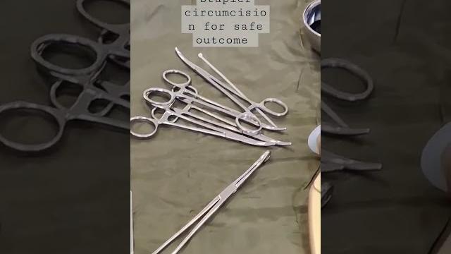 Best circumcision surgery with stapler a day care procedure for safe outcome. #circumcision Best circumcision surgery with stapler a day care procedure for safe outcome. #circumcision