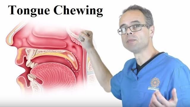 Tongue chewing by dr mike mew Tongue chewing by dr mike mew