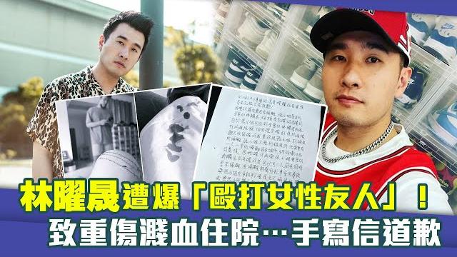 林曜晟遭爆「毆打女性友人」! 致重傷濺血住院…手寫信道歉 林曜晟遭爆「毆打女性友人」! 致重傷濺血住院…手寫信道歉