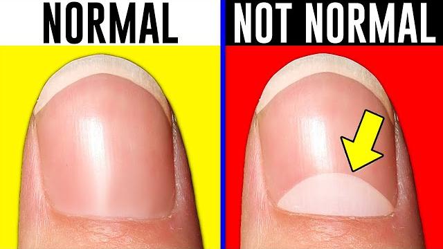 10 signs you're actually normal.. 10 signs you're actually normal..