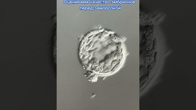 #дети #бесплодие #женское #зачатие #экопоомс #малыш #ребенок #медицина #беременность #узи #лечение #дети #бесплодие #женское #зачатие #экопоомс #малыш #ребенок #медицина #беременность #узи #лечение