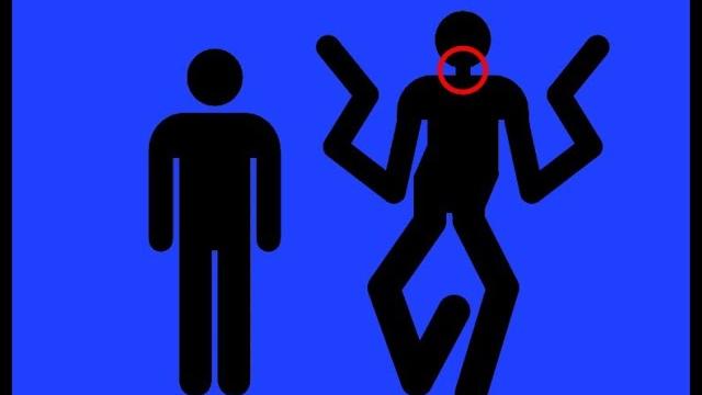 Оплетаи нападают на людей в лесах / главное управление мчс россии по магнитошахтинской области Оплетаи нападают на людей в лесах / главное управление мчс россии по магнитошахтинской области