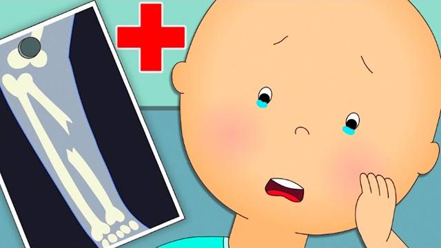 Caillou’s broken bone | caillou cartoon Caillou’s broken bone | caillou cartoon