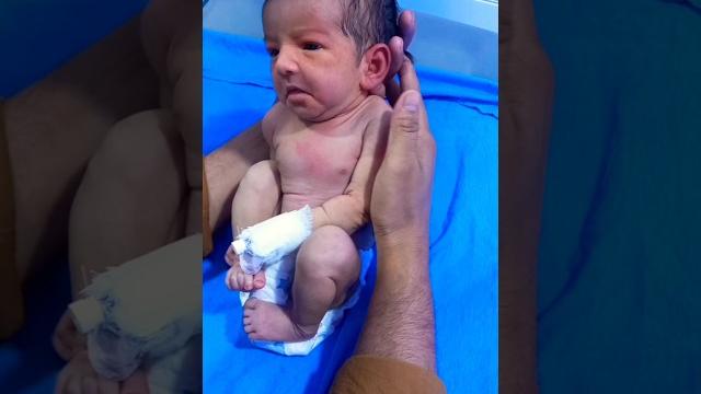 The yawning rabbit newborn reaction | shorts expression | shorts reaction | @newbornbabytech The yawning rabbit newborn reaction | shorts expression | shorts reaction | @newbornbabytech