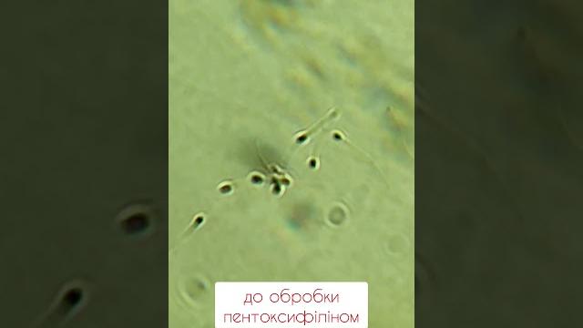 Restoration of sperm motility by pentoxifylline. відновлення рухливості сперматозоїдів. #sperm #art Restoration of sperm motility by pentoxifylline. відновлення рухливості сперматозоїдів. #sperm #art