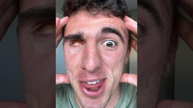 Youtube eyeball Youtube eyeball