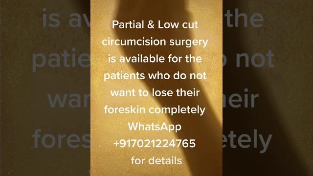 Partial circumcision Partial circumcision
