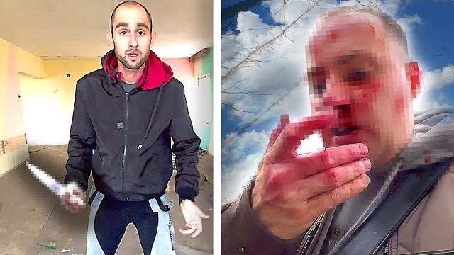 Псих догнал меня и сломал но.. маньяк набросился на меня с но. неадекват быдло хотел меня завалить Псих догнал меня и сломал но.. маньяк набросился на меня с но. неадекват быдло хотел меня завалить