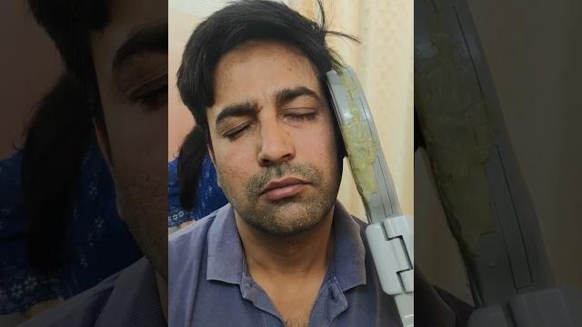 Bells palsy treatment#dmrt#robotic class 4 laser#advance bells palsy treatment #stimulator Bells palsy treatment#dmrt#robotic class 4 laser#advance bells palsy treatment #stimulator