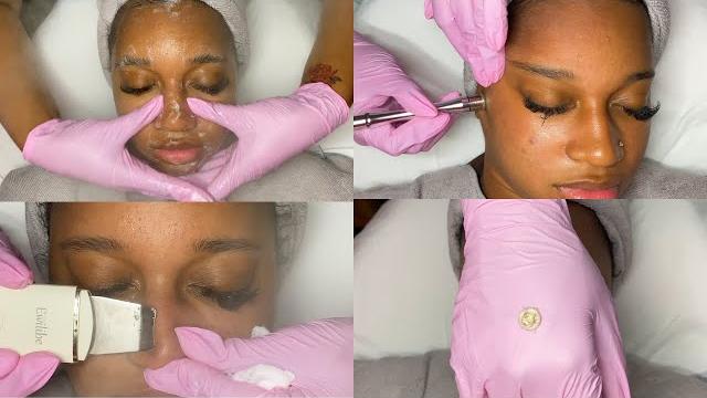 Summer glow facial w/ microdermabrasion | glambylialeigh Summer glow facial w/ microdermabrasion | glambylialeigh