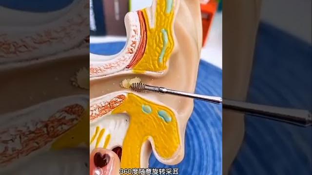 耳朵痒了就用这个6件套掏耳勺,舒适又干净 掏耳勺 好物分享 耳朵痒了就用这个6件套掏耳勺,舒适又干净 掏耳勺 好物分享
