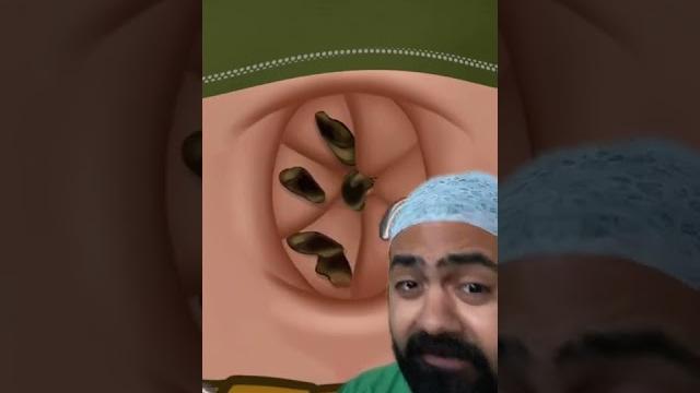 Doctor reacts to lost baggage in bellybutton Doctor reacts to lost baggage in bellybutton
