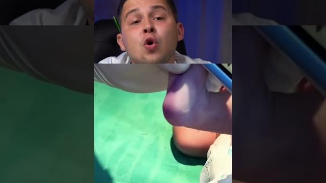 Как проверяют глюкозу у младенцев Как проверяют глюкозу у младенцев